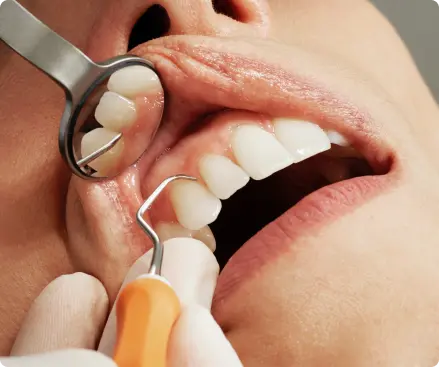 Odontología conservadora