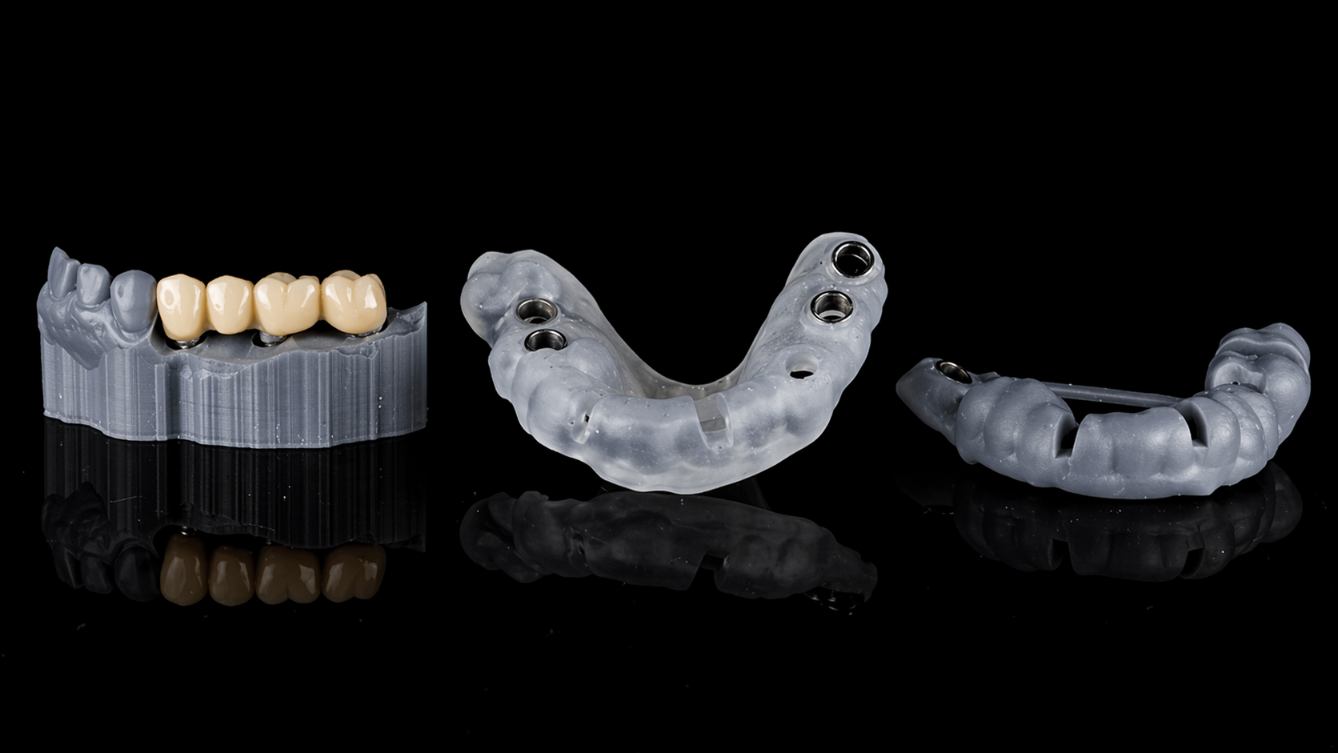Prótesis con sistema CAD-CAM de fresado en Clínica Dental Aldaz
