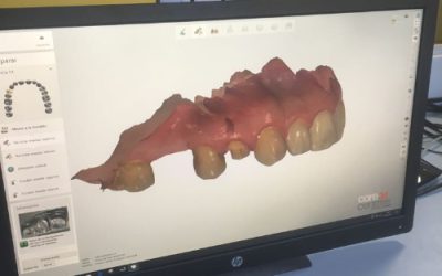 CAD/CAM EN DENTAL ALDAZ