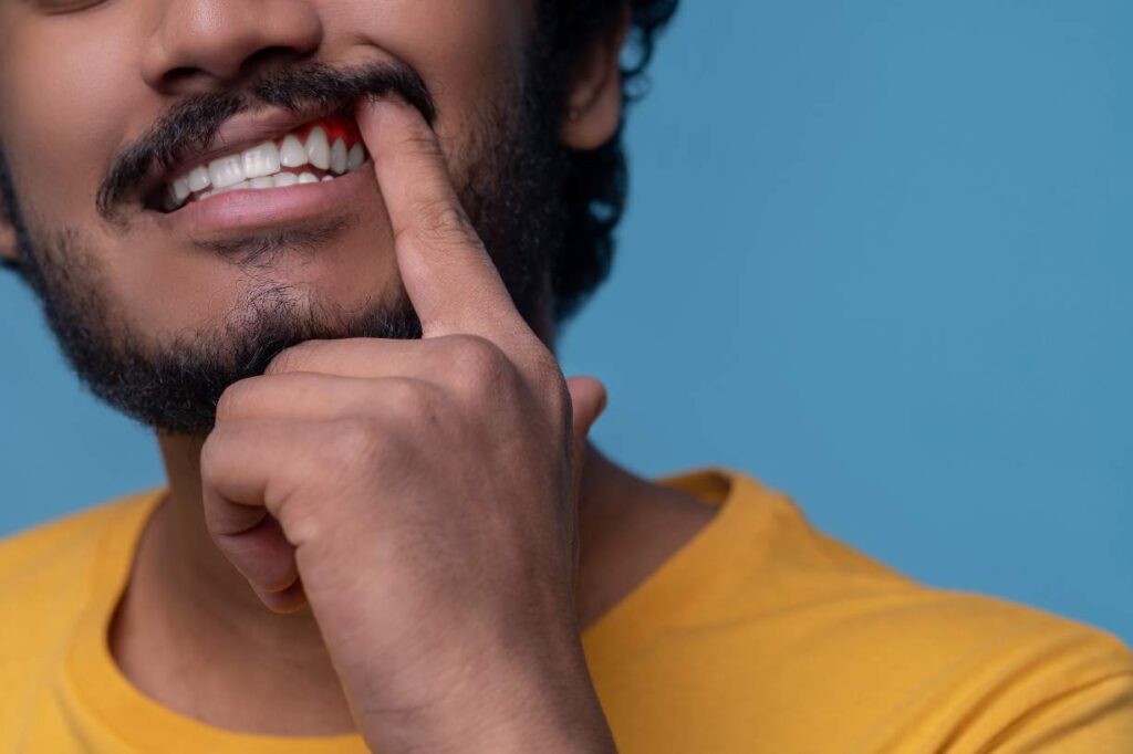Cropped photo of a bearded mustached guy demonstrating his white teeth and red inflamed gums
