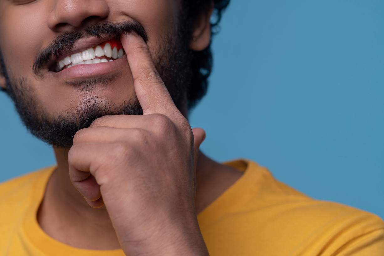 Imagen Cropped photo of a bearded mustached guy demonstrating his white teeth and red inflamed gums